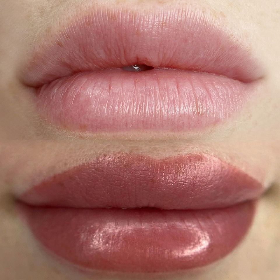 Lip-Blush_11 Lip Blushing