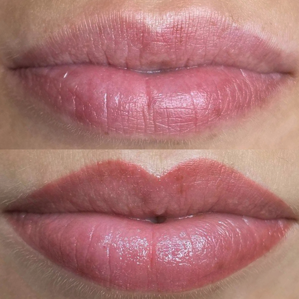 Lip-Blush_3 Lip Blushing