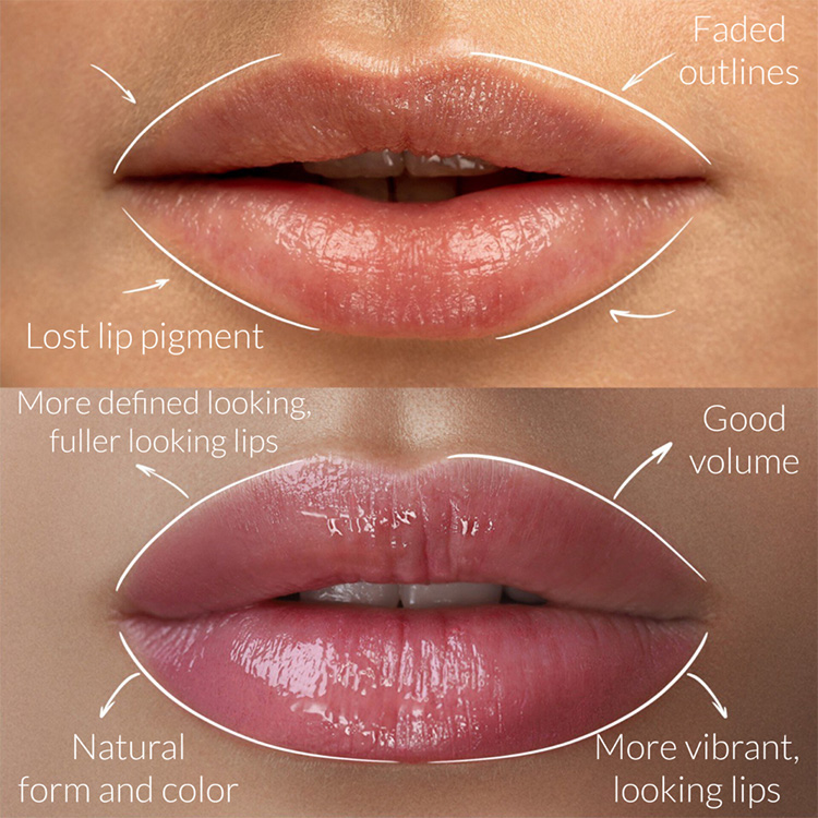 Photo-from-Google-Drive Lip Blushing